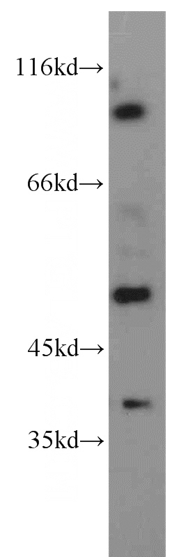 Y79 cells were subjected to SDS PAGE followed by western blot with Catalog No:113667(PDE6C antibody) at dilution of 1:200