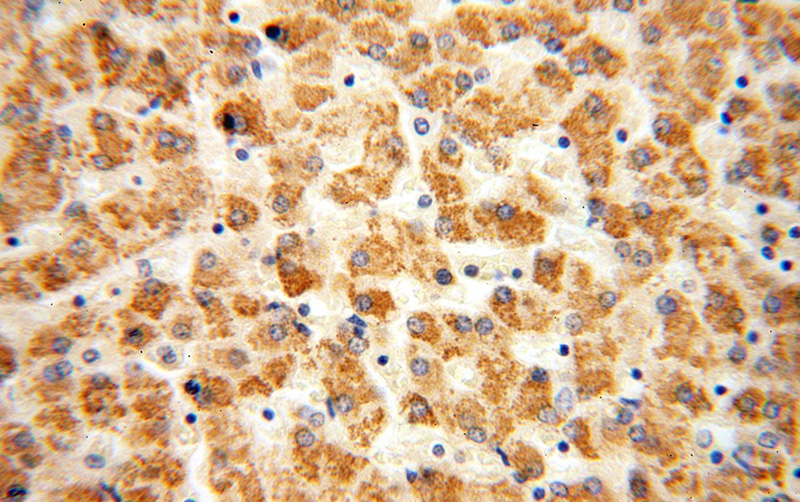 Immunohistochemical of paraffin-embedded human liver using Catalog No:111331(HACL1 antibody) at dilution of 1:100 (under 40x lens)