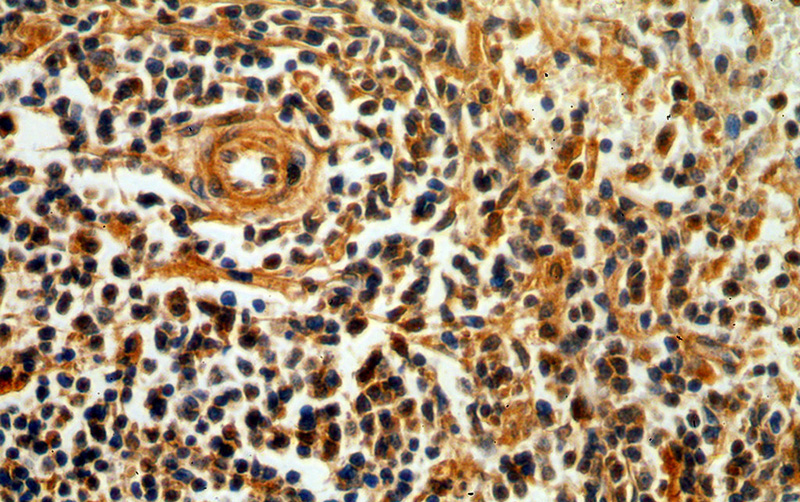 Immunohistochemical of paraffin-embedded human spleen using Catalog No:113471(POU2F2-Specific antibody) at dilution of 1:100 (under 40x lens)