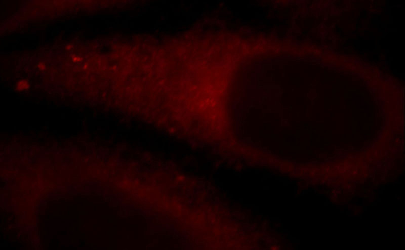 Immunofluorescent analysis of HepG2 cells, using SCARB1 antibody Catalog No:115664 at 1:25 dilution and Rhodamine-labeled goat anti-rabbit IgG (red).
