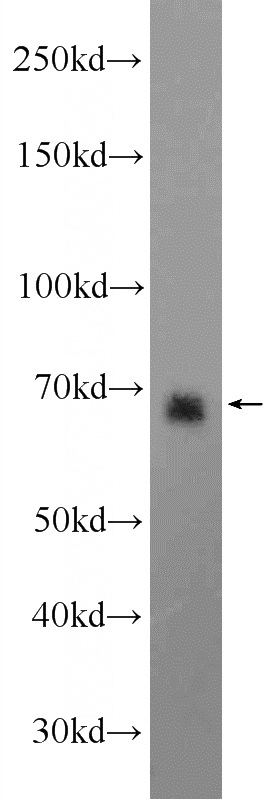 HEK-293 cells were subjected to SDS PAGE followed by western blot with Catalog No:108994(CCDC99 Antibody) at dilution of 1:1000
