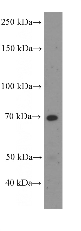 MCF-7 cells were subjected to SDS PAGE followed by western blot with (FRS2 Antibody) at dilution of 1:1000