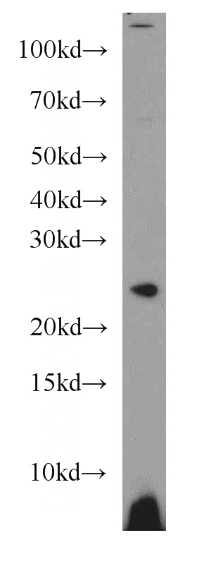 Jurkat cells were subjected to SDS PAGE followed by western blot with Catalog No:110976(GINS3 antibody) at dilution of 1:800