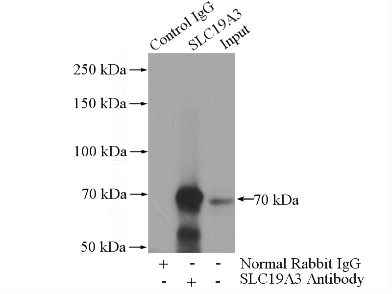 IP Result of anti-SLC19A3 (IP:Catalog No:115308, 4ug; Detection:Catalog No:115308 1:600) with mouse liver tissue lysate 4000ug.