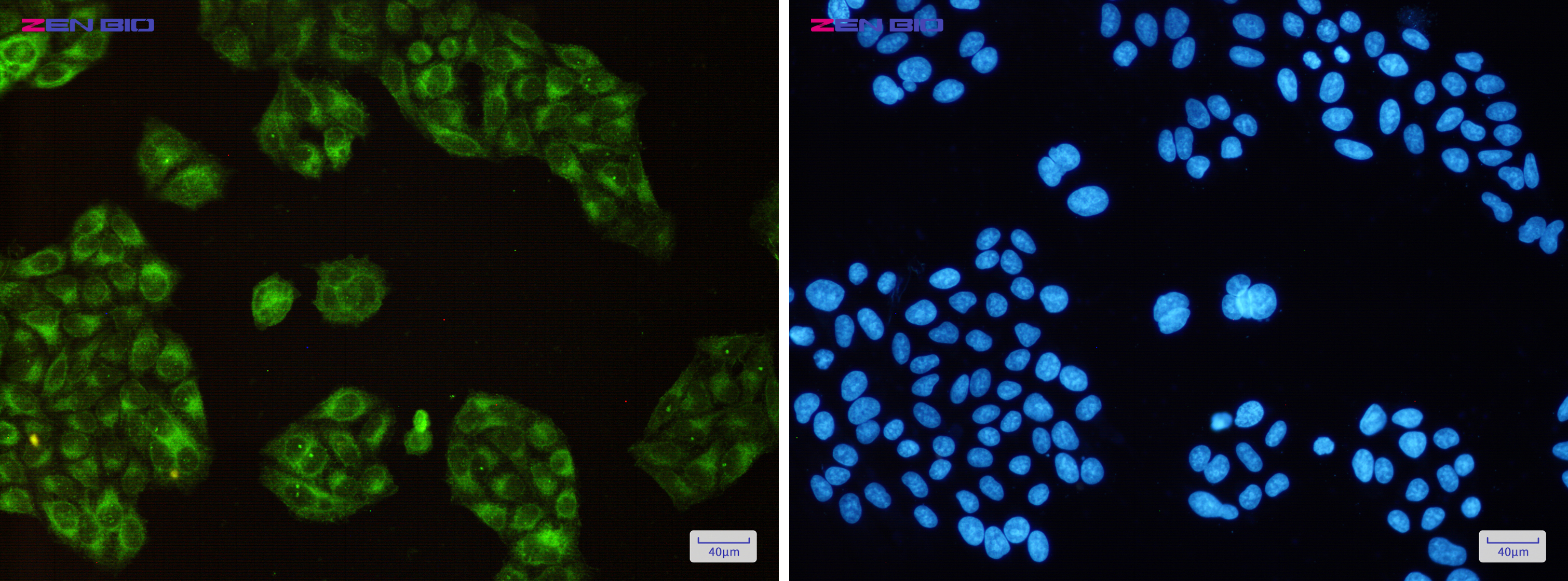Immunocytochemistry of SCD1(green) in Hela cells using SCD1 Rabbit pAb at dilution 1/50, and DAPI(blue)