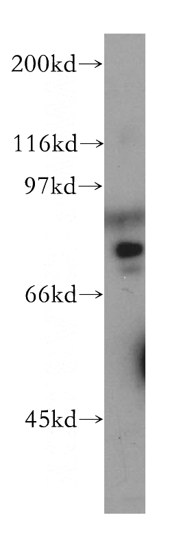 K-562 cells were subjected to SDS PAGE followed by western blot with Catalog No:114510(RAD17 antibody) at dilution of 1:400