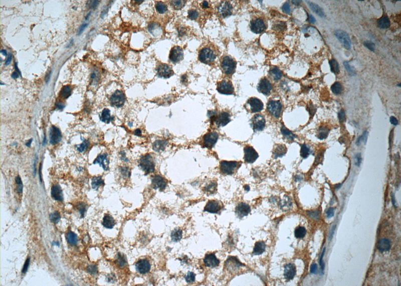 Immunohistochemistry of paraffin-embedded human testis slide using Catalog No:114644(RGS17 Antibody) at dilution of 1:50