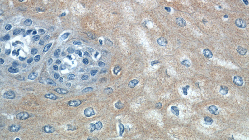 Immunohistochemistry of paraffin-embedded human oesophagus tissue slide using Catalog No:115645(SPRR2F Antibody) at dilution of 1:50 (under 40x lens)