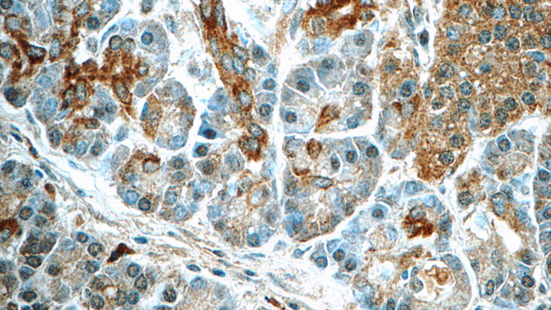 Immunohistochemistry of paraffin-embedded human pancreas tissue slide using Catalog No:115200(SERPINB10 Antibody) at dilution of 1:50 (under 40x lens)