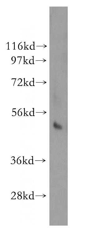 human spleen tissue were subjected to SDS PAGE followed by western blot with Catalog No:113159(NFKBIE antibody) at dilution of 1:500