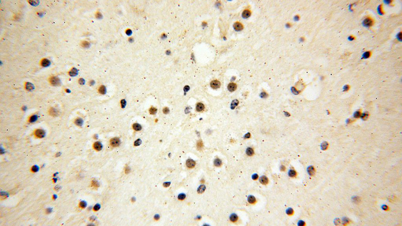 Immunohistochemical of paraffin-embedded human brain using Catalog No:109847(DEDD2 antibody) at dilution of 1:100 (under 40x lens)