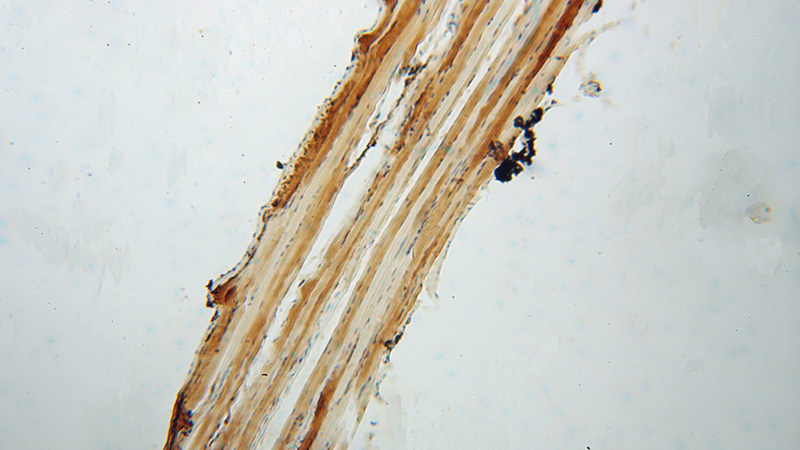 Immunohistochemical of paraffin-embedded human skeletal muscle using Catalog No:108748(CA3 antibody) at dilution of 1:100 (under 10x lens)