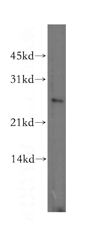 human brain tissue were subjected to SDS PAGE followed by western blot with Catalog No:109998(DLX1 antibody) at dilution of 1:300