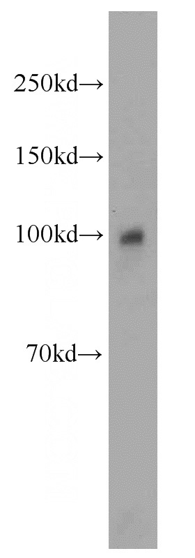 A375 cells were subjected to SDS PAGE followed by western blot with Catalog No:113461(OAS3 antibody) at dilution of 1:800