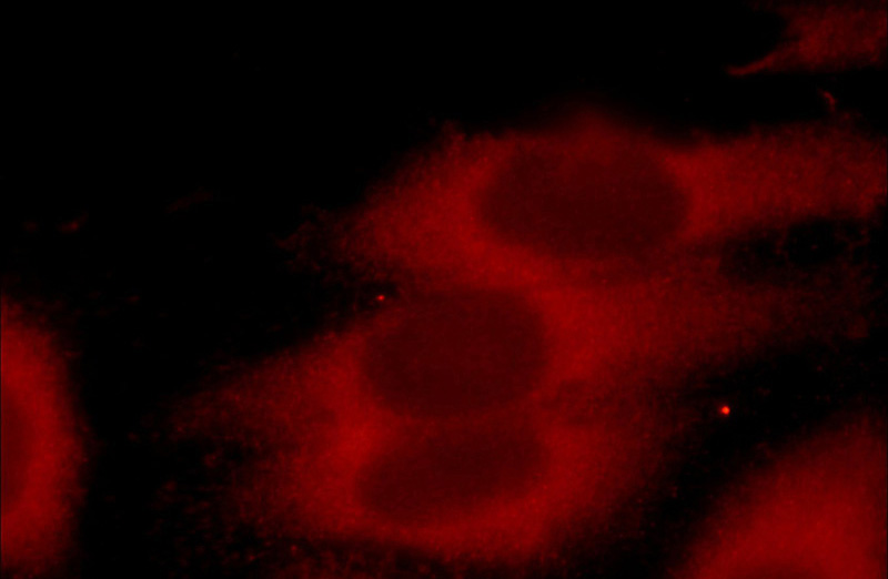 Immunofluorescent analysis of HepG2 cells using Catalog No:109892(DEPDC6 Antibody) at dilution of 1:25 and Rhodamine-Goat anti-Rabbit IgG