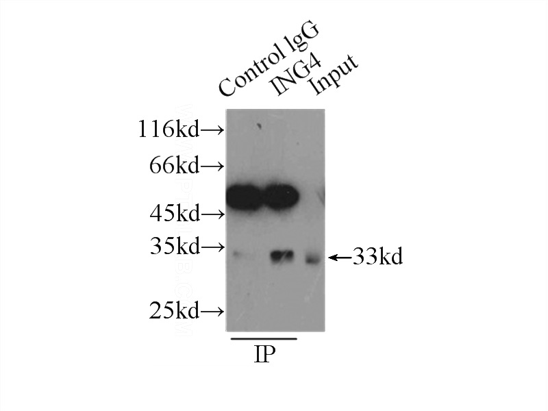 IP Result of anti-ING4-specific (IP:Catalog No:111796, 3ug; Detection:Catalog No:111796 1:300) with HeLa cells lysate 2500ug.