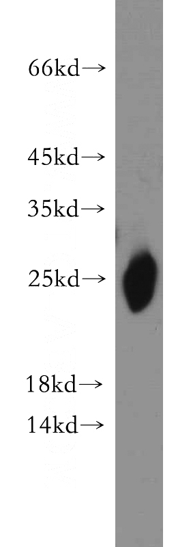 A549 cells were subjected to SDS PAGE followed by western blot with Catalog No:108895(CAV1 antibody) at dilution of 1:300