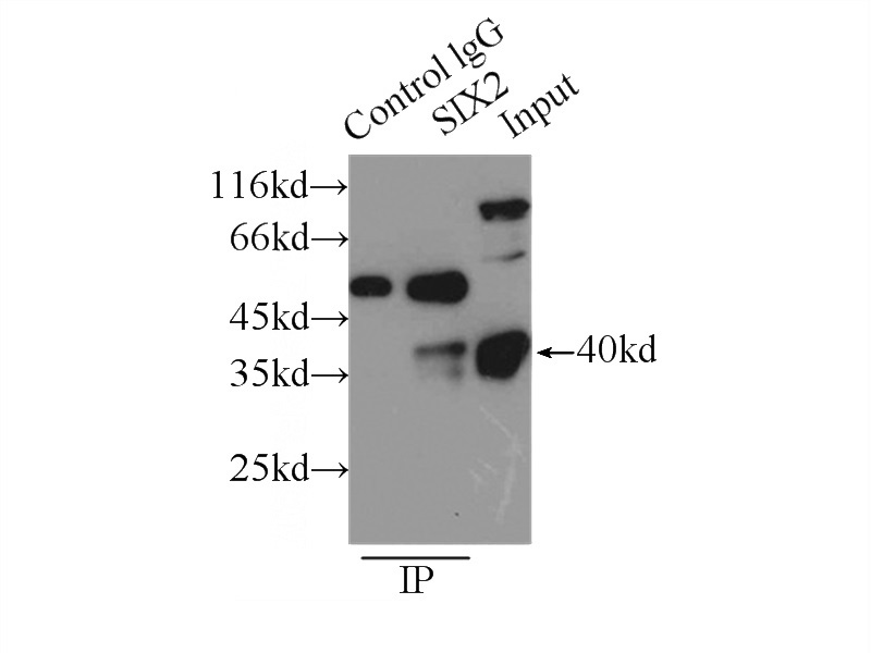 IP Result of anti-SIX2 (IP:Catalog No:115250, 3ug; Detection:Catalog No:115250 1:500) with HEK-293 cells lysate 2700ug.