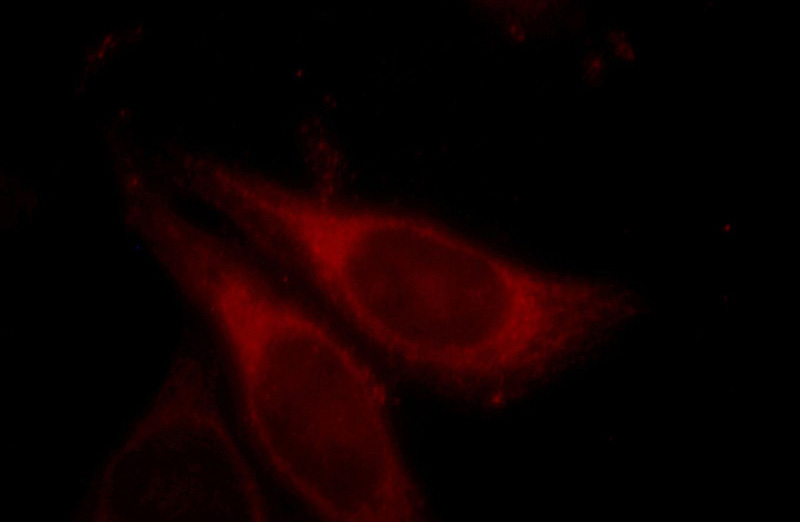 Immunofluorescent analysis of HepG2 cells, using ALDOB antibody Catalog No:107977 at 1:25 dilution and Rhodamine-labeled goat anti-rabbit IgG (red).