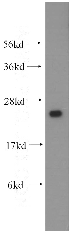 HeLa cells were subjected to SDS PAGE followed by western blot with Catalog No:111666(HSPB11 antibody) at dilution of 1:500
