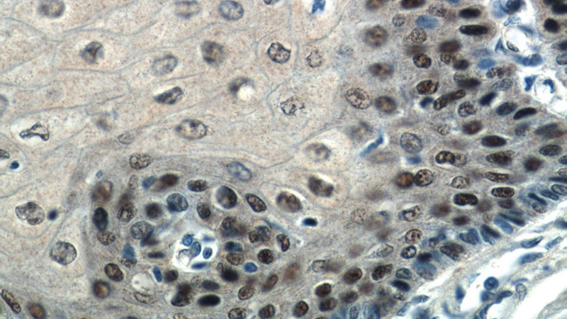 Immunohistochemistry of paraffin-embedded human oesophagus tissue slide using Catalog No:116399(TRMT6 Antibody) at dilution of 1:100 (under 40x lens)