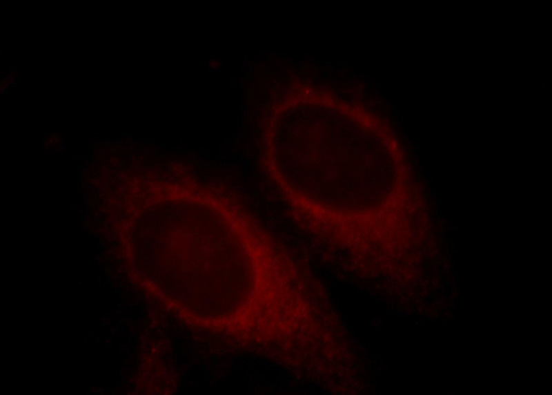 Immunofluorescent analysis of HepG2 cells, using SKP1 antibody Catalog No:115289 at 1:25 dilution and Rhodamine-labeled goat anti-rabbit IgG (red).