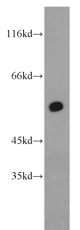 MCF7 cells were subjected to SDS PAGE followed by western blot with Catalog No:114945(RXRA antibody) at dilution of 1:600