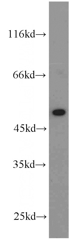 mouse brain tissue were subjected to SDS PAGE followed by western blot with Catalog No:113120(NeuN antibody) at dilution of 1:1000