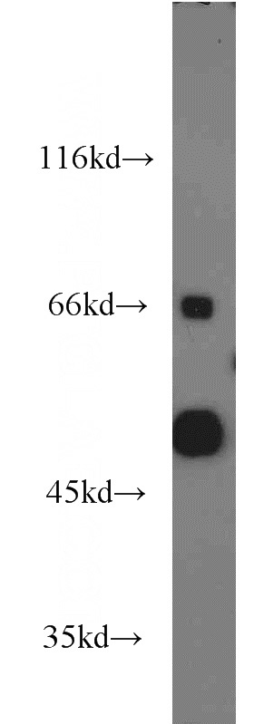 mouse liver tissue were subjected to SDS PAGE followed by western blot with Catalog No:107968(ALDH3A2 antibody) at dilution of 1:1200