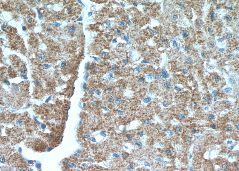 Immunohistochemical of paraffin-embedded human heart using Catalog No:115175(SGSM3 antibody) at dilution of 1:100 (under 40x lens)