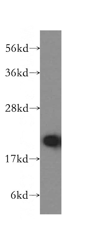 human liver tissue were subjected to SDS PAGE followed by western blot with Catalog No:114811(RPL11 antibody) at dilution of 1:500