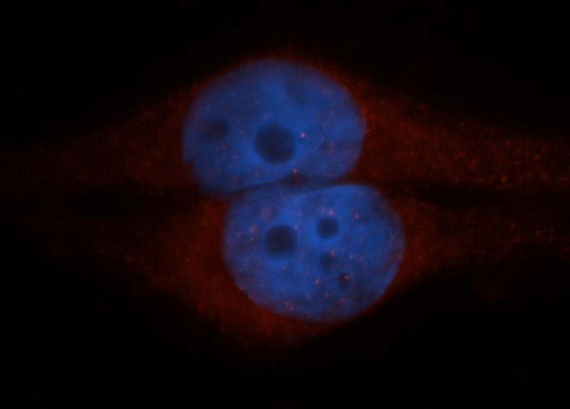 Immunofluorescent analysis of HepG2 cells, using CLIC1 antibody Catalog No:109388 at 1:50 dilution and Rhodamine-labeled goat anti-rabbit IgG (red). Blue pseudocolor = DAPI (fluorescent DNA dye).