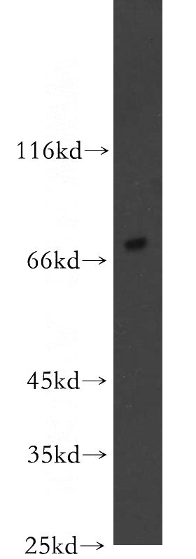 SH-SY5Y cells were subjected to SDS PAGE followed by western blot with Catalog No:115268(SHC4 antibody) at dilution of 1:300