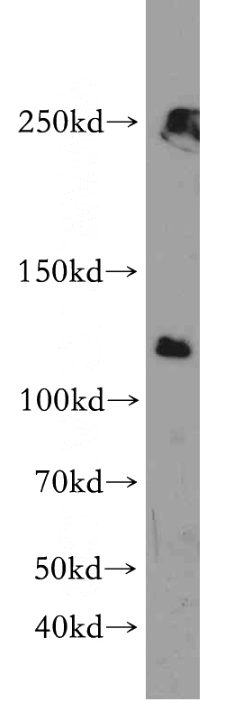 HEK-293 cells were subjected to SDS PAGE followed by western blot with Catalog No:114539(RANBP6 antibody) at dilution of 1:200