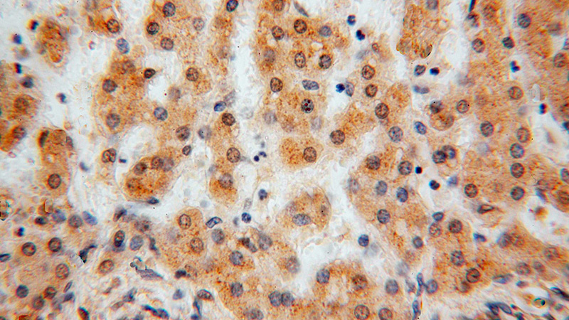 Immunohistochemical of paraffin-embedded human liver using Catalog No:116371(TSR2 antibody) at dilution of 1:50 (under 40x lens)