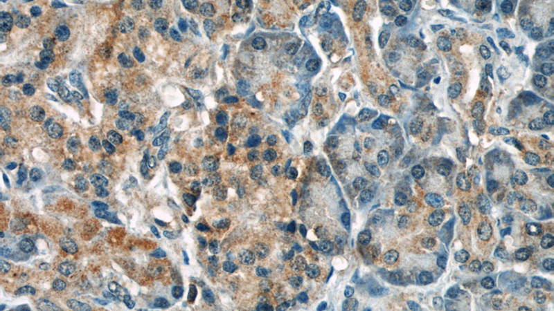 Immunohistochemical of paraffin-embedded human pancreas using Catalog No:111316(GULP1 antibody) at dilution of 1:50 (under 40x lens)