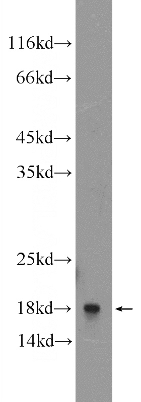 A549 cells were subjected to SDS PAGE followed by western blot with Catalog No:114884(RPL27A Antibody) at dilution of 1:300
