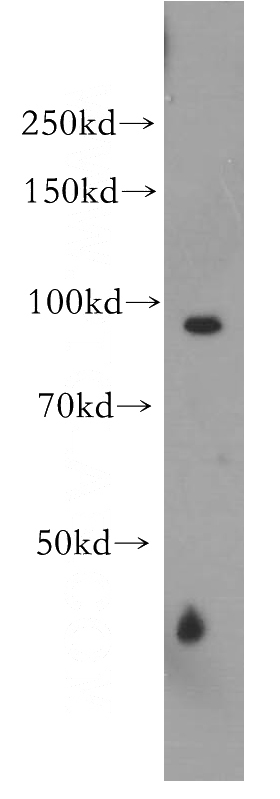 PC-3 cells were subjected to SDS PAGE followed by western blot with Catalog No:116978(WWP1 antibody) at dilution of 1:300