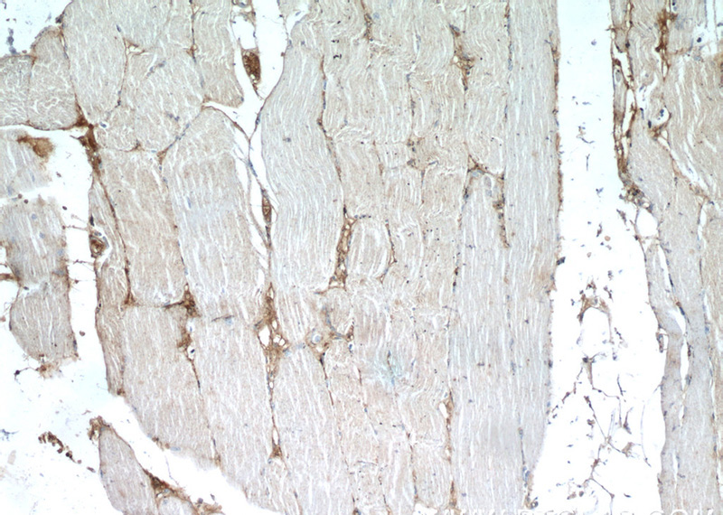Immunohistochemistry of paraffin-embedded human skeletal muscle tissue slide using Catalog No:110055(DOK7 Antibody) at dilution of 1:50 (under 10x lens)