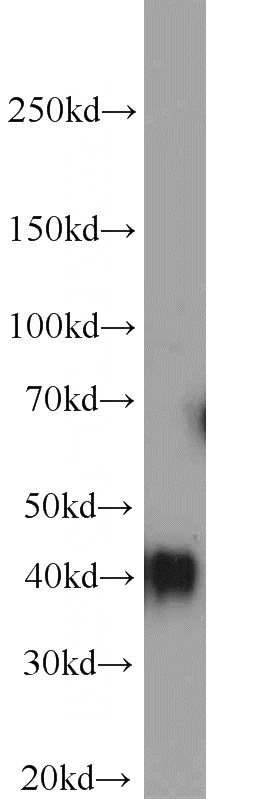 Jurkat cells were subjected to SDS PAGE followed by western blot with Catalog No:116102(TMEM165 antibody) at dilution of 1:3000