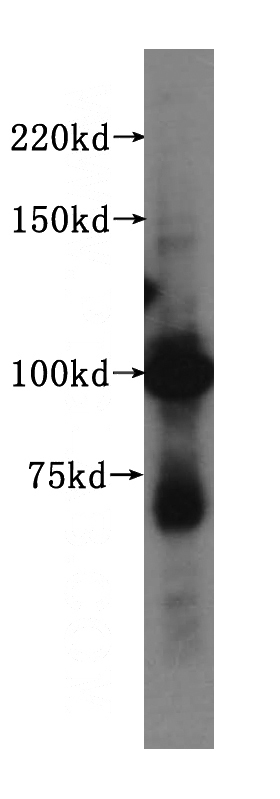 K-562 cells were subjected to SDS PAGE followed by western blot with Catalog No:108120(AP2B1 antibody) at dilution of 1:500