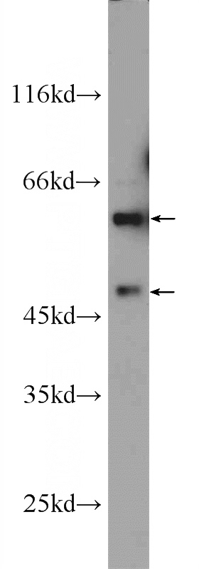 HepG2 cells were subjected to SDS PAGE followed by western blot with Catalog No:108239(ARCN1 antibody) at dilution of 1:1000