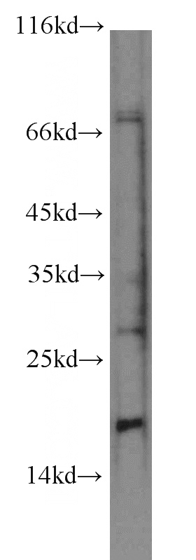 SH-SY5Y cells were subjected to SDS PAGE followed by western blot with Catalog No:113723(PSPN-Specific antibody) at dilution of 1:500