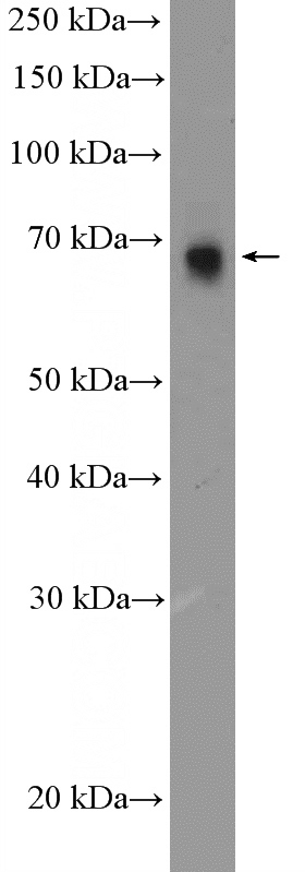 PC-3 cells were subjected to SDS PAGE followed by western blot with Catalog No:112028(KDM4D Antibody) at dilution of 1:600