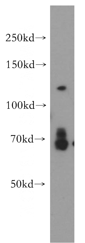 HEK-293 cells were subjected to SDS PAGE followed by western blot with Catalog No:116611(USP37 antibody) at dilution of 1:500