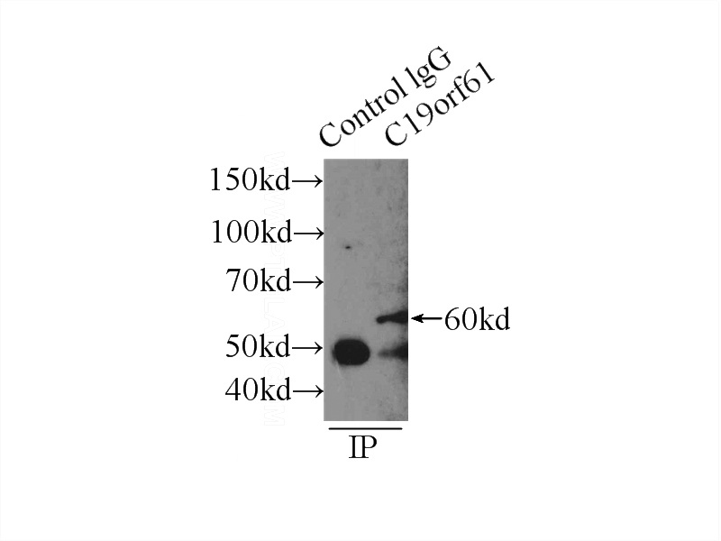IP Result of anti-C19orf61 (IP:Catalog No:108626, 3ug; Detection:Catalog No:108626 1:500) with HeLa cells lysate 2000ug.