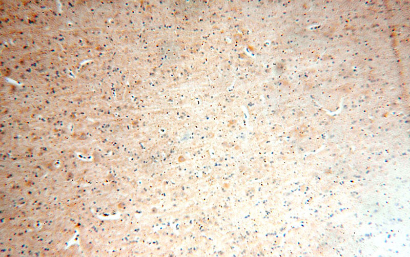 Immunohistochemical of paraffin-embedded human brain using Catalog No:114875(RPL19 antibody) at dilution of 1:100 (under 10x lens)