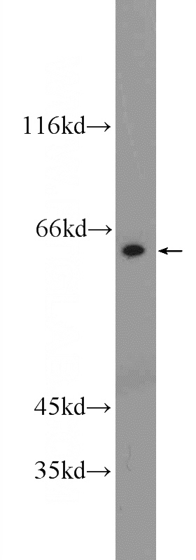 A431 cells were subjected to SDS PAGE followed by western blot with Catalog No:114581(RCOR3 Antibody) at dilution of 1:600