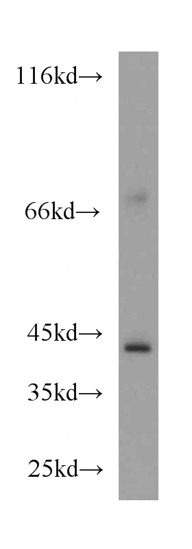 mouse kidney tissue were subjected to SDS PAGE followed by western blot with Catalog No:114137(PPM1L antibody) at dilution of 1:500