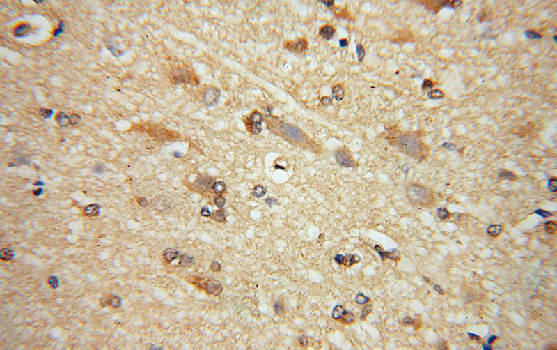 Immunohistochemical of paraffin-embedded human brain using Catalog No:111210(GRIPAP1 antibody) at dilution of 1:50 (under 40x lens)